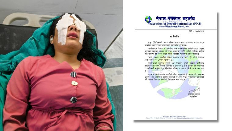 प्रहरीको पानीको फोहोराले लागेर पत्रकारकार्की घाइते, पत्रकार महासंघ भन्छ स्वतन्तत्रतामाथि प्रहार भयो !